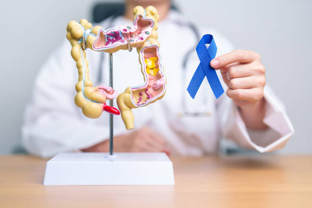 Screening gratuito tumore del colon retto